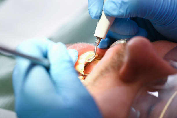 Best Weekend Emergency Dentist in Lake Kiowa, TX