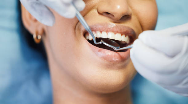 Best Emergency Dental Care for Broken or Chipped Teeth in Lake Kiowa, TX